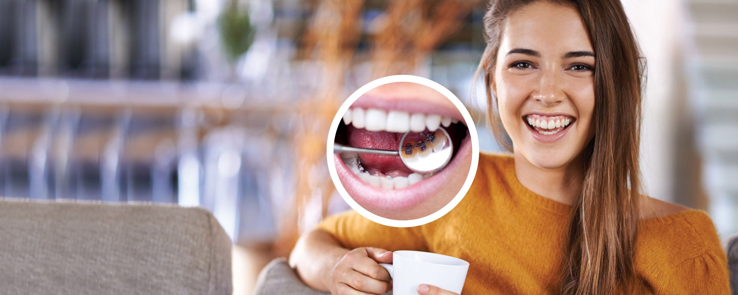 Lingual braces. 