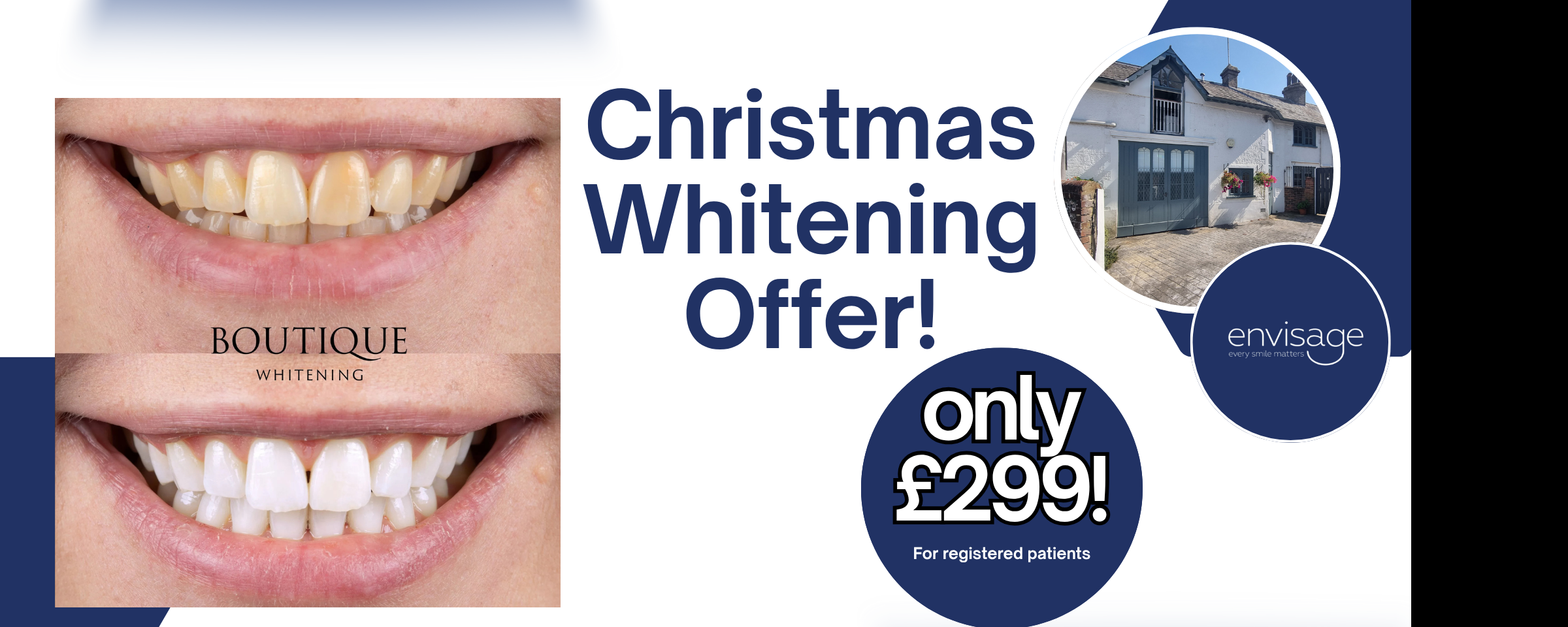 Teeth Whitening Offer!