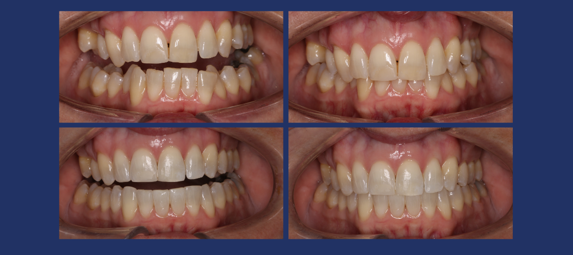 Vanessa's orthodontic journey